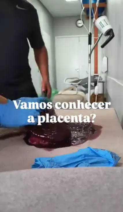 Post: vamos conhecer a placenta?